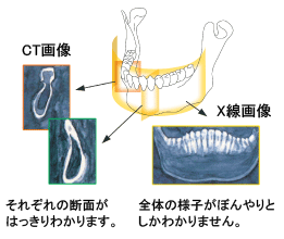 CT摜EX摜